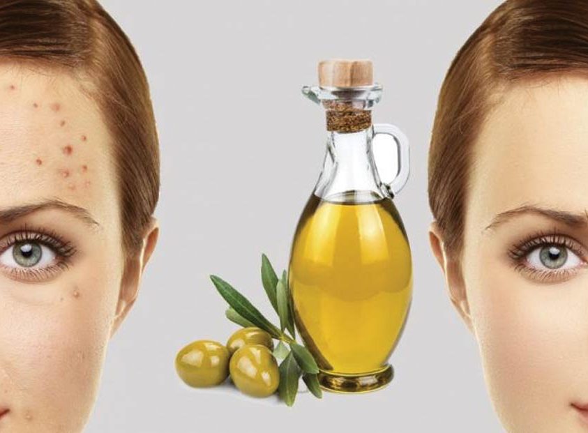 روغن زیتون برای لک صورت